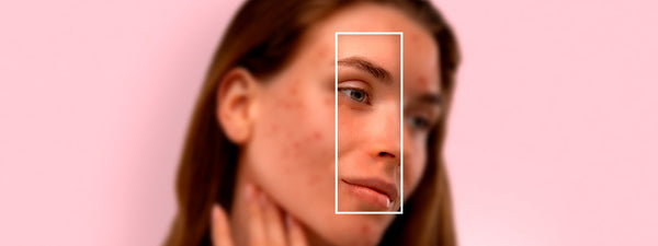 सेंसिटिव स्किन के लिए सुरक्षित टैन रिमूवल स्क्रब