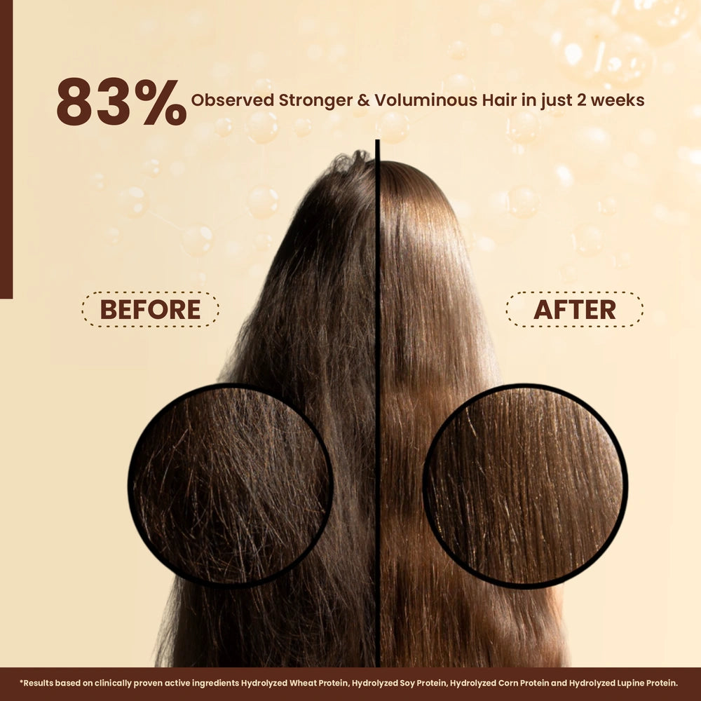 Lemon & Ginger Anti-Dandruff Shampoo  100% Nourishment & Scalp Care