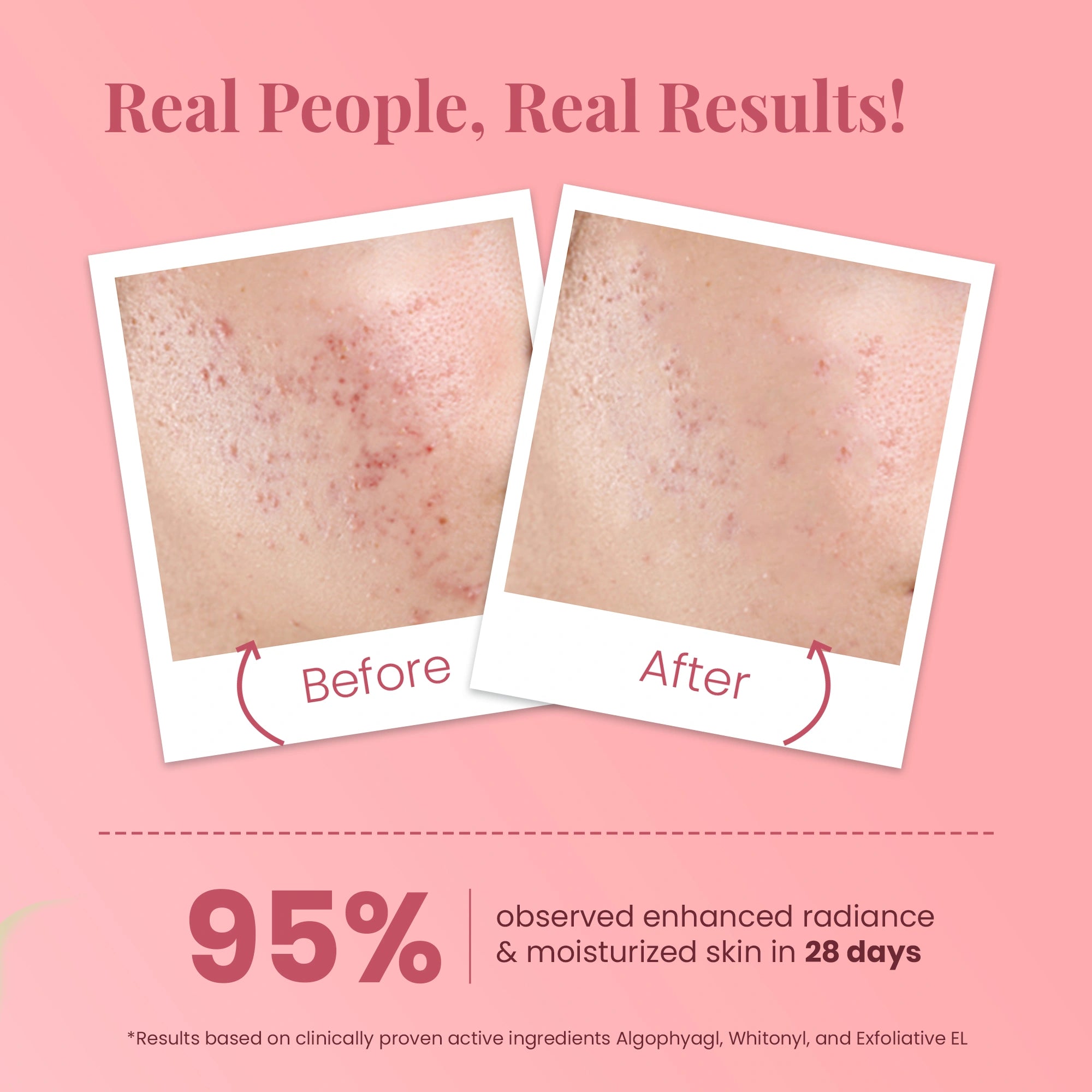 Glass Skin Ideal Bright Face Serum for All Skin
