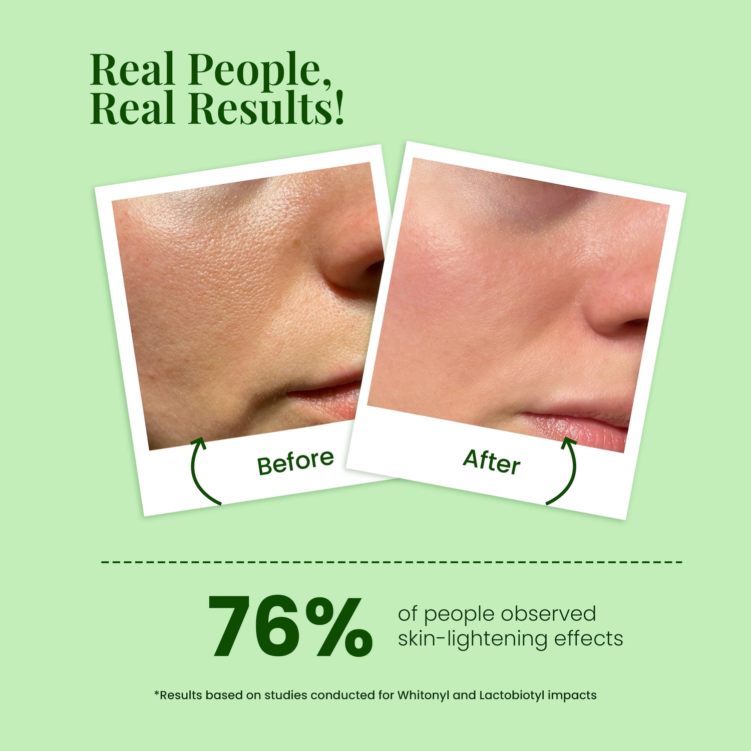 Vitamin C Day Regimen Combo(Pack of 4)