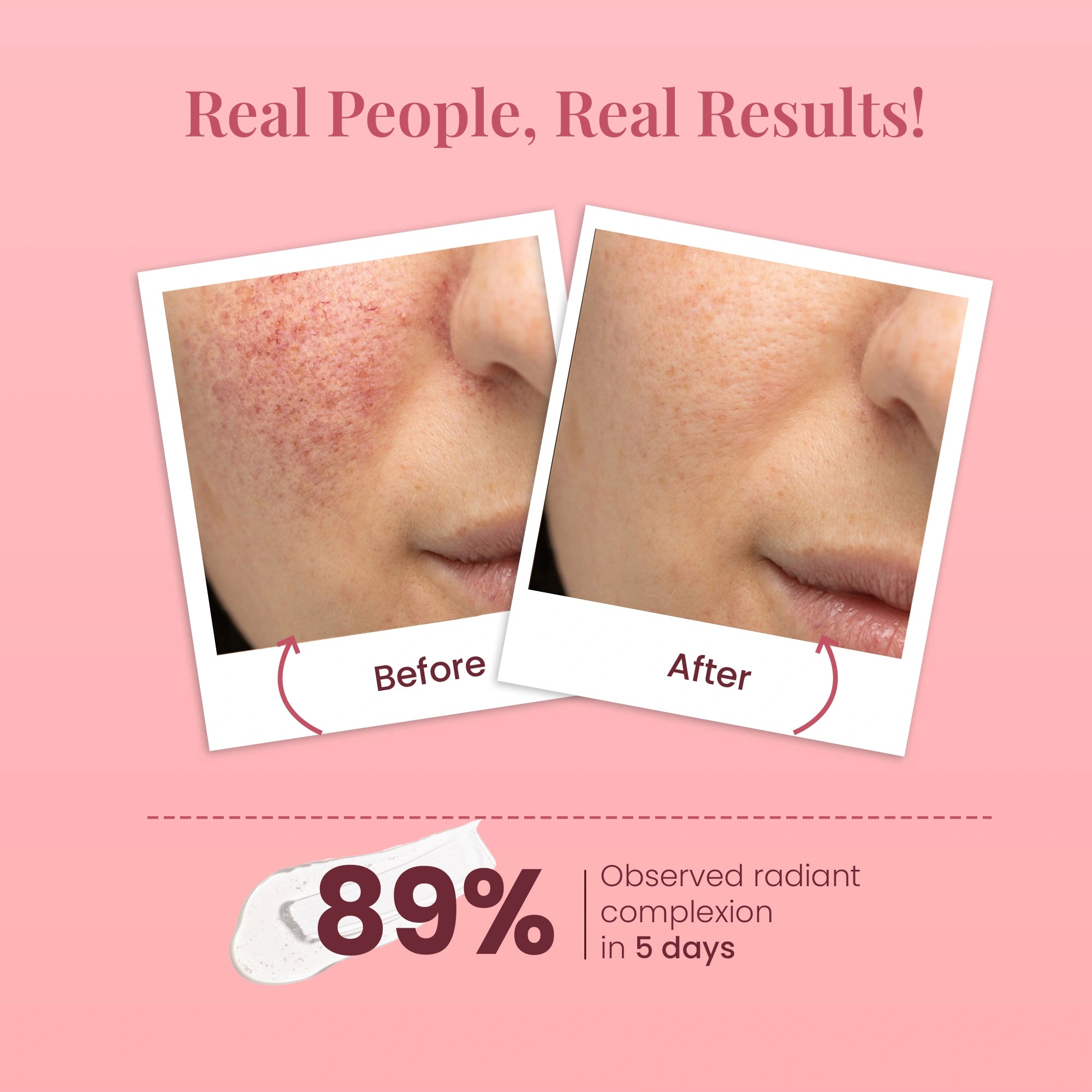 Ideal Bright Face Wash mini Pack