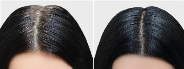 Maintaining Optimal Skin & Scalp pH After Monsoon