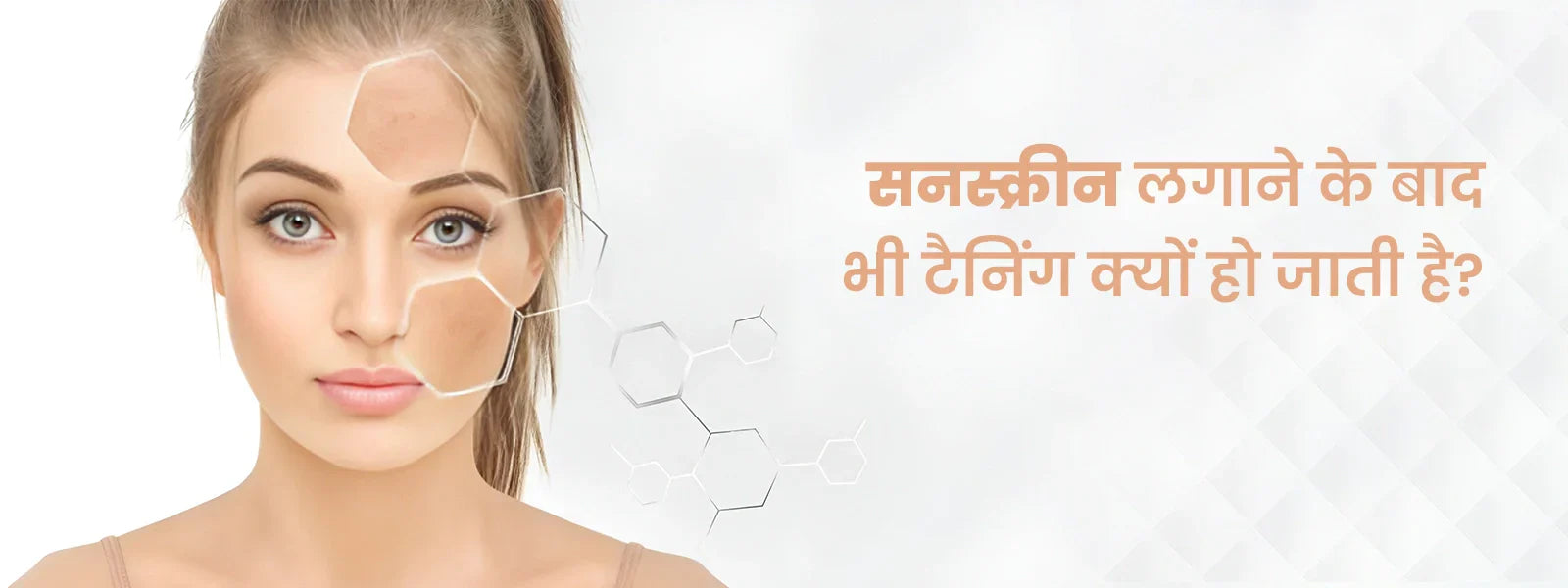 Woman with a clear skin patch over sunburned area, text in Hindi on a light background
