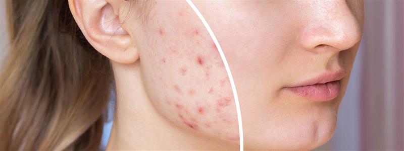 महिलाओं के लिए बेस्ट फेस क्रीम