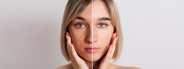 ग्लोइंग स्किन के लिए फेस क्रीम: घरेलू और मार्केट के बेस्ट विकल्प