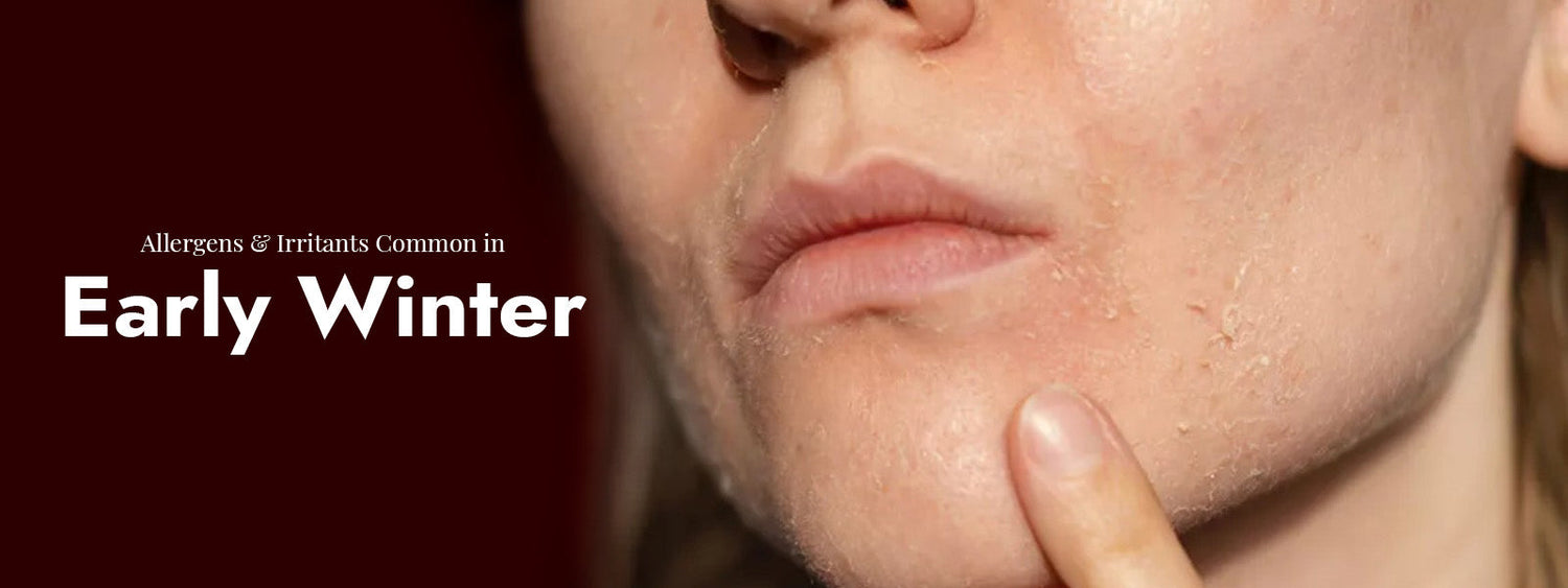 Allergens & Irritants Common