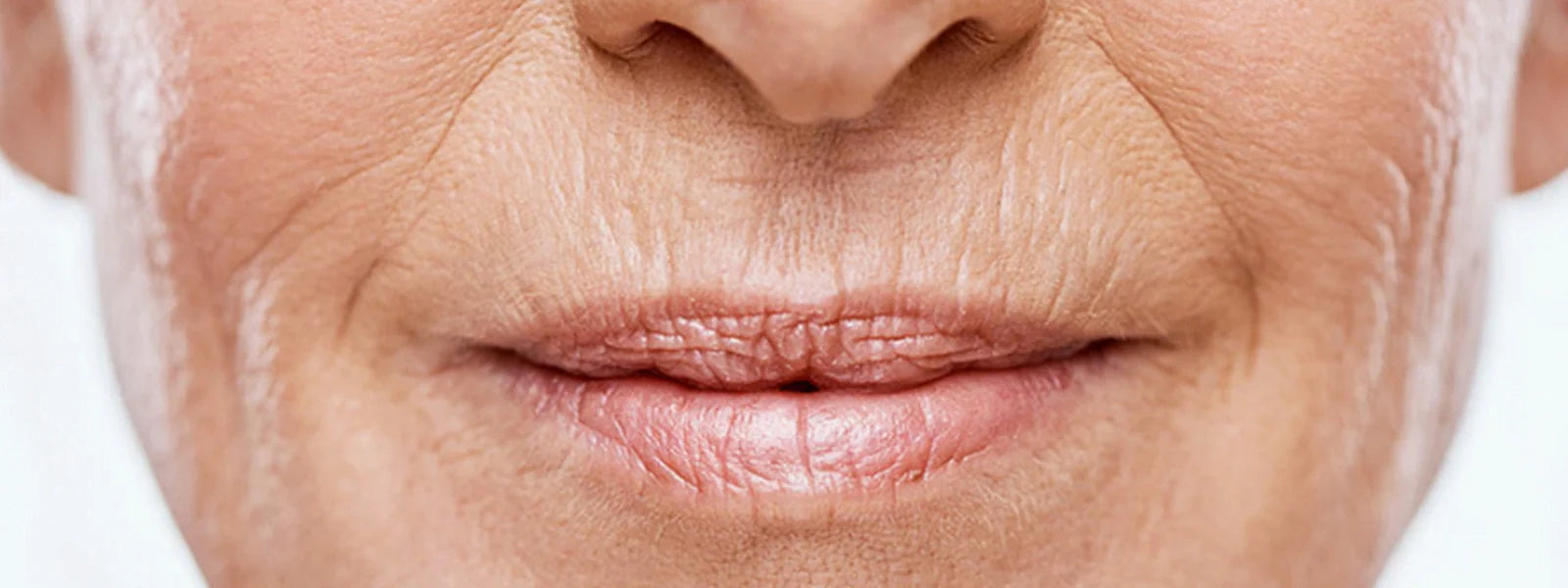 Face Fine Line Reduction