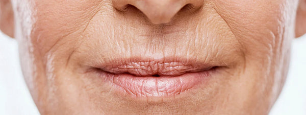 Face Fine Line Reduction