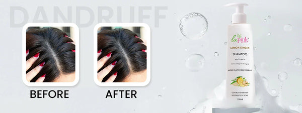 Best Summer Hair Care: Natural & Anti-Dandruff Shampoos for Healthy Scalp | La Pink