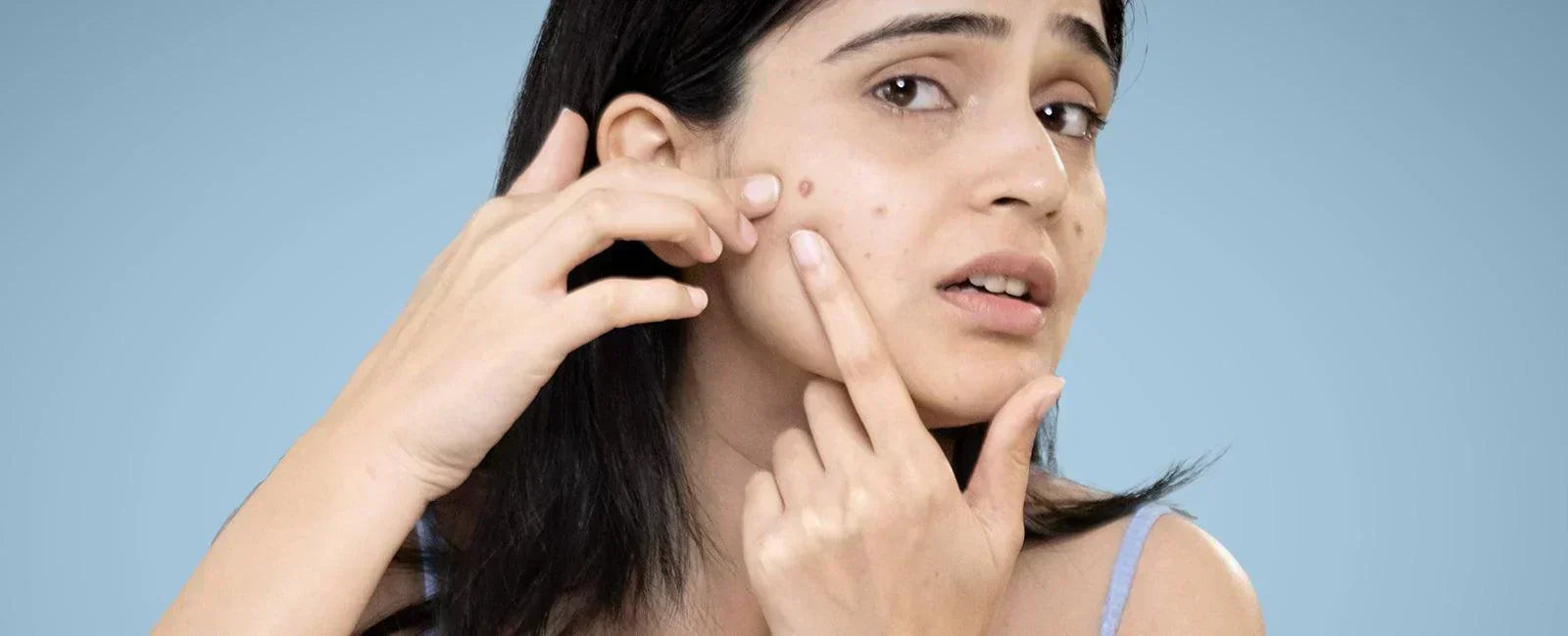 हर सुबह नए पिंपल्स के साथ उठ रही हैं?