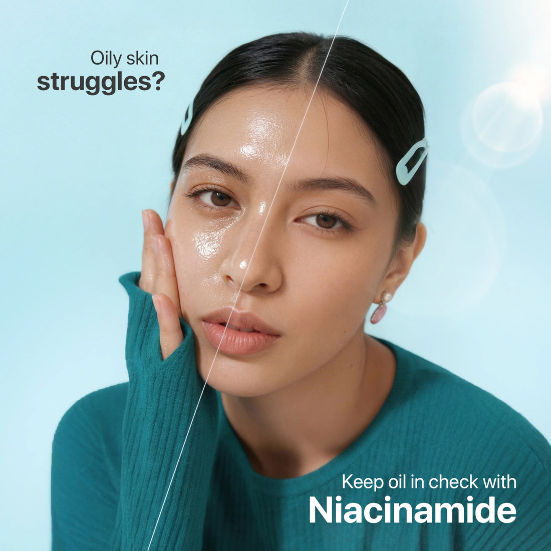 Woman with oily skin on a blue background with text about niacinamide.