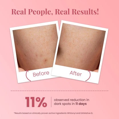 Tan removal Ideal Bright Face Scrub for Glass Like Skin