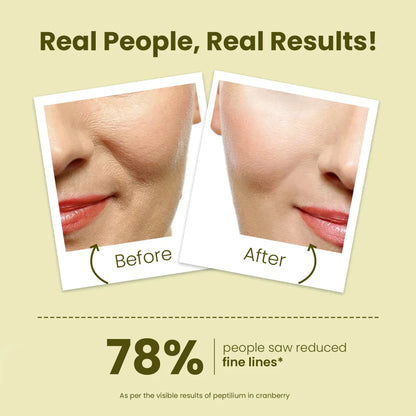 Buy Best Face Mask for Anti Aging Youthful Radiant Skin