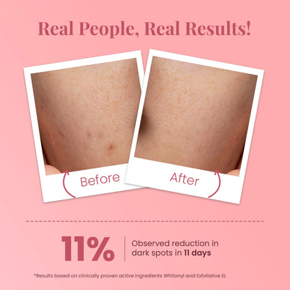 Tan removal Ideal Bright Face Scrub for Glass Like Skin