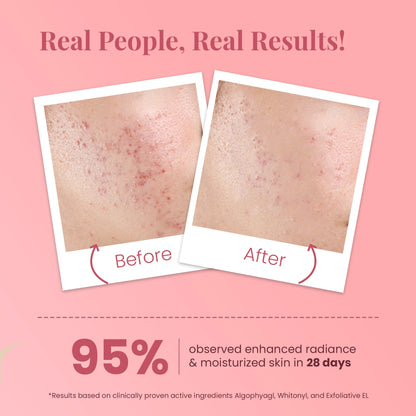 Glass Skin Ideal Bright Face Serum for All Skin