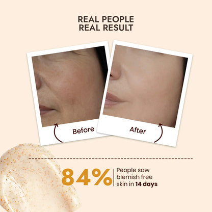 Ubtan Face Wash for Tan Removal